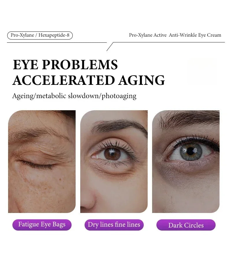Instant Eye Bag Removal Cream Retinol Anti-Wrinkle Firming Skin Fade Fine Lines Anti Dark Circle Puffiness Brighten Eye skinCare