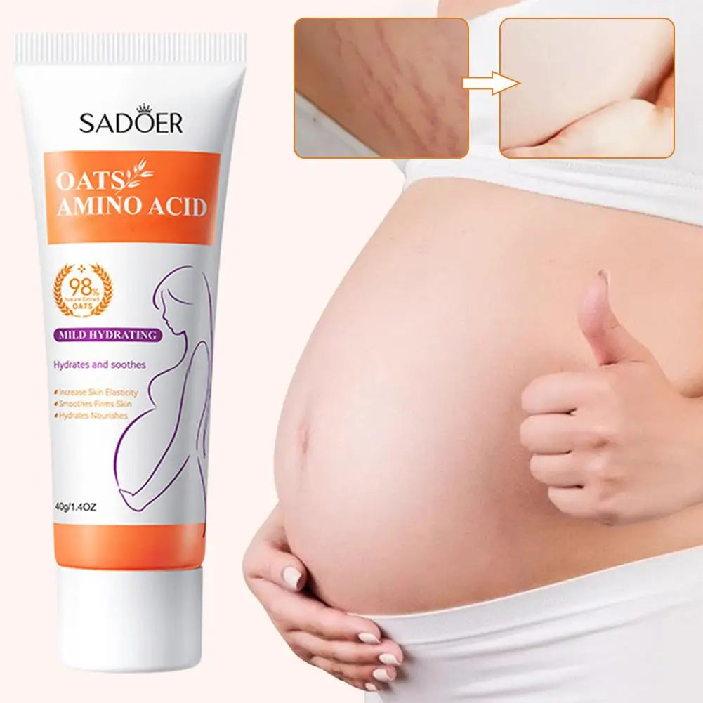 Removes Stretch Mark Cream To Remove Postpartum Obesity Pregnant Women Repair Anti-Aging Winkles Firming Body Cream Skin Care