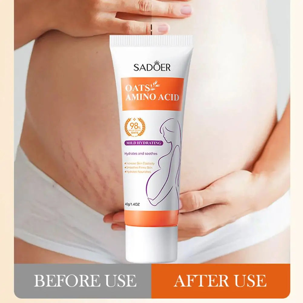 Removes Stretch Mark Cream To Remove Postpartum Obesity Pregnant Women Repair Anti-Aging Winkles Firming Body Cream Skin Care