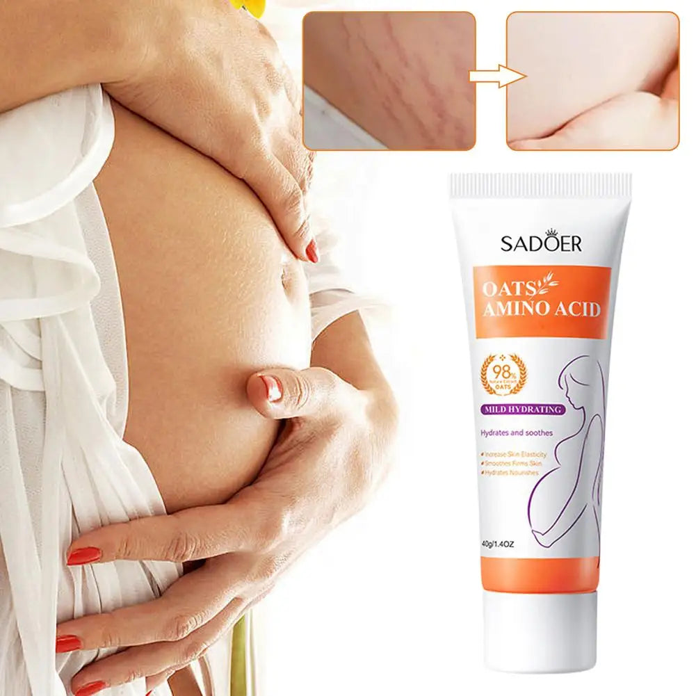 Removes Stretch Mark Cream To Remove Postpartum Obesity Pregnant Women Repair Anti-Aging Winkles Firming Body Cream Skin Care